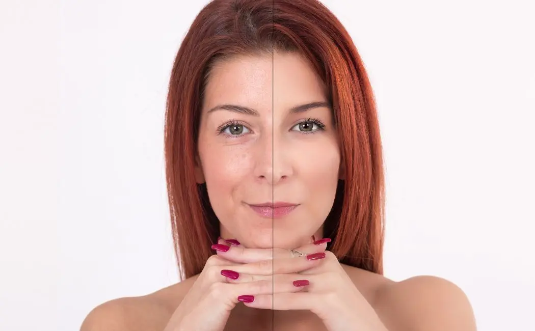 Jak zapobiegać starzeniu się skóry?