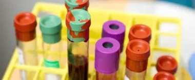 Hemofilia nie krwawi mocniej, ale dłużej – na Mazowszu żyje z nią już ponad tysiąc osób